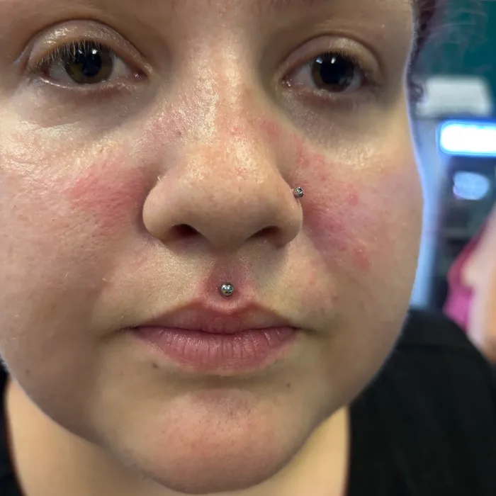 Nostril and philtrum piercing closeup